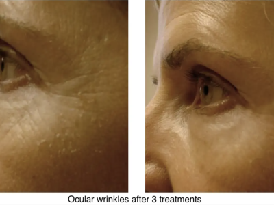 Screenshot 2025-03-04 at 3.37.31 PM